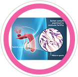 Male Infertility